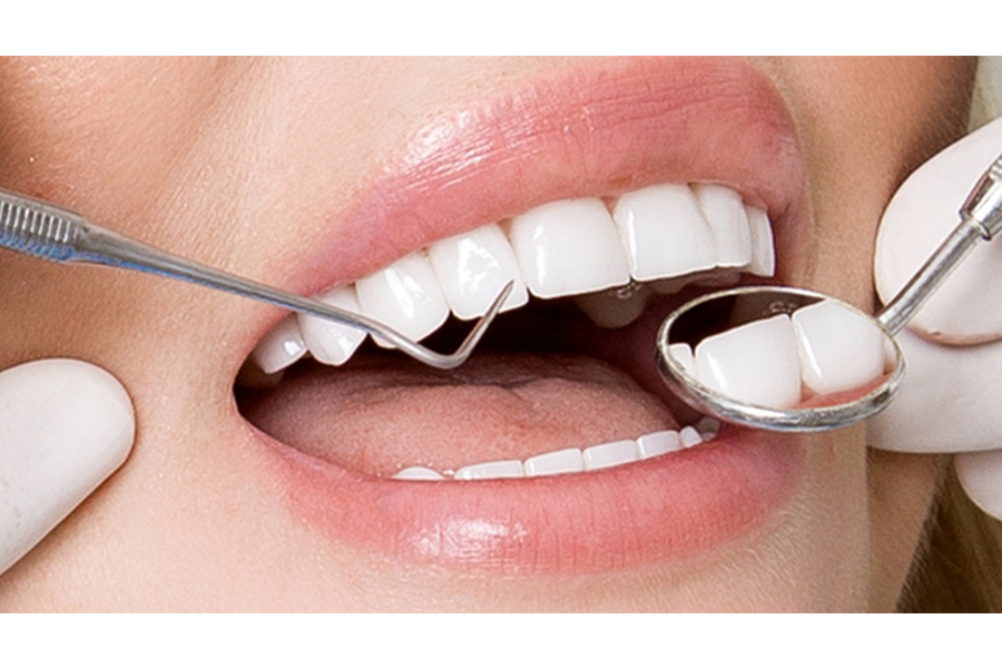 Bảng giá răng sứ tại các nha khoa hiện nay