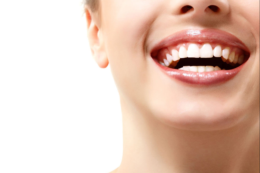Lưu ý Trước Và Sau Khi Tẩy Trắng Răng