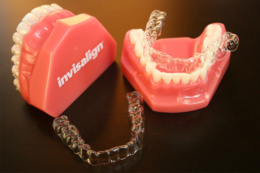 Niềng Răng Trong Suốt Invisalign