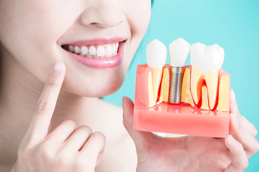 Quá Trình Cấy Ghép Implant Tại Nha Khoa đông A