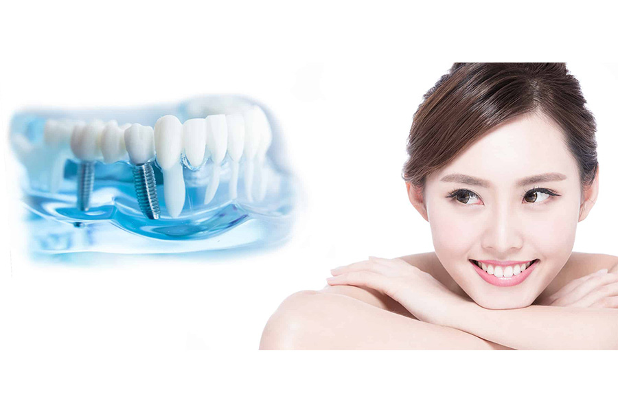 Ưu điểm Của Việc Trồng Răng Implant