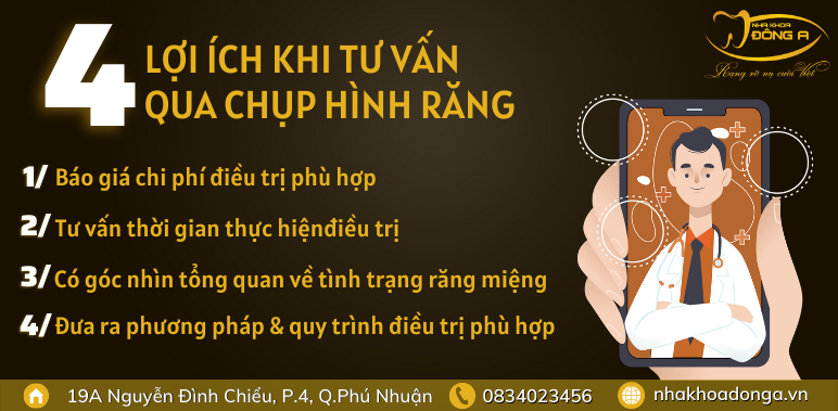 4-loi-ich-khi-chup-hinh-rang-nha-tu-van