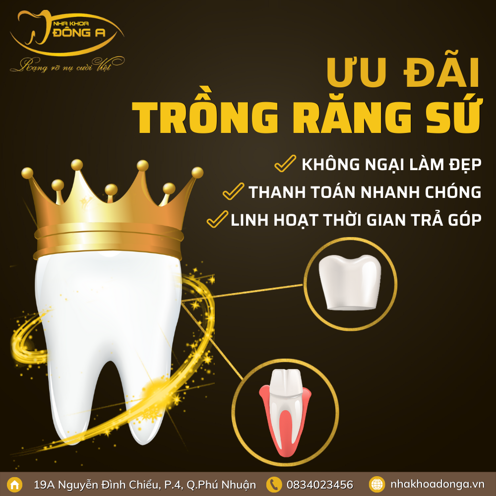 phuong-thuc-dang-ky-trong-rang-su