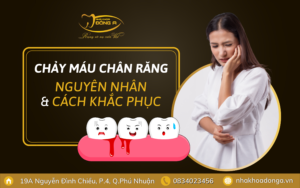 Chay Mau Chan Rang Dai Dien