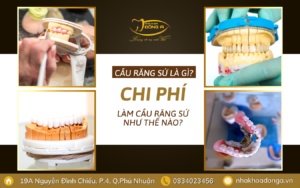 Cau Rang Su La Gi