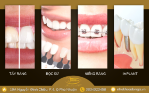 Dep Toan Dien Voi 4 Phuong Phap Tan Trang