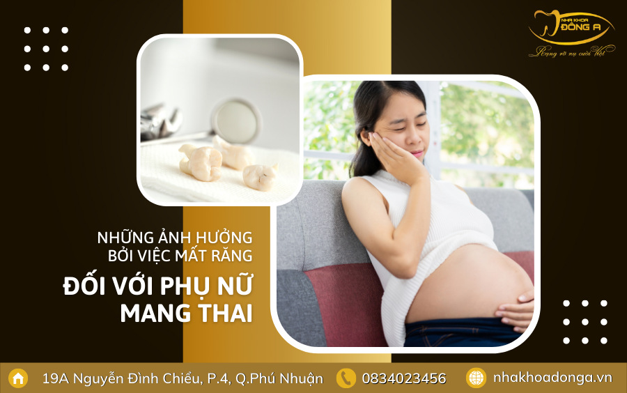Phu Nu Mang Thai Co Nen Trong Rang Implant 1