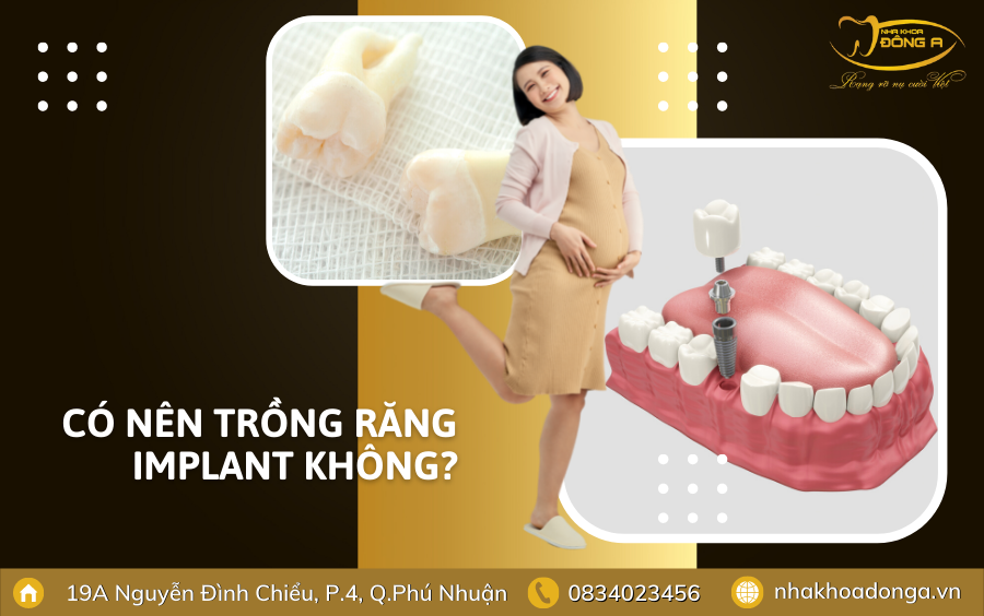 Phu Nu Mang Thai Co Nen Trong Rang Implant 2