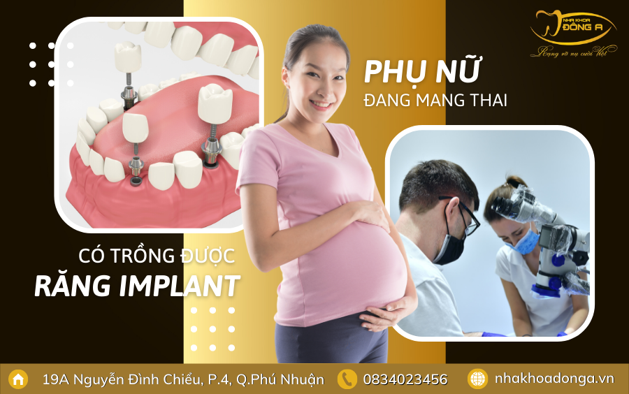 Phu Nu Mang Thai Co Nen Trong Rang Implant