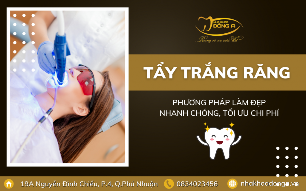 Tay Trang Rang
