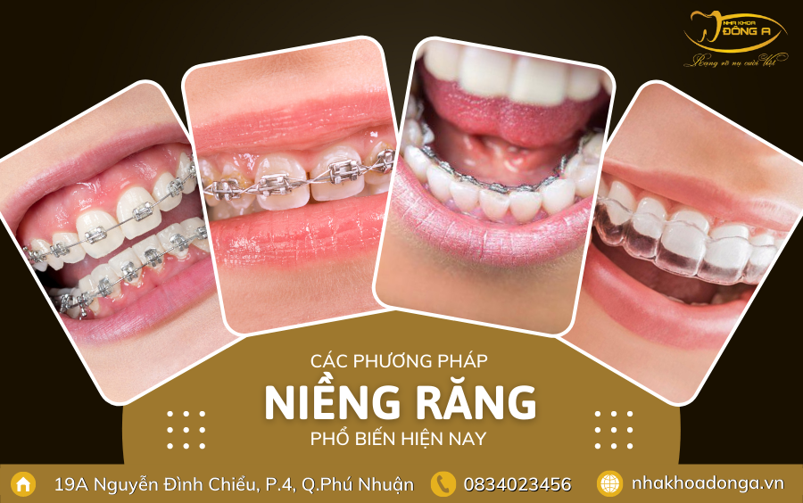 Cac Phuong Phap Nieng Rang Pho Bien
