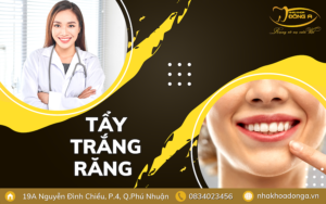 Khi Nao Nen Va Khong Nen Tay Trang Rang