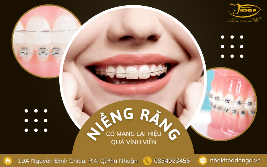Nieng Rang Co Mang Lai Hieu Qua Vinh Vien