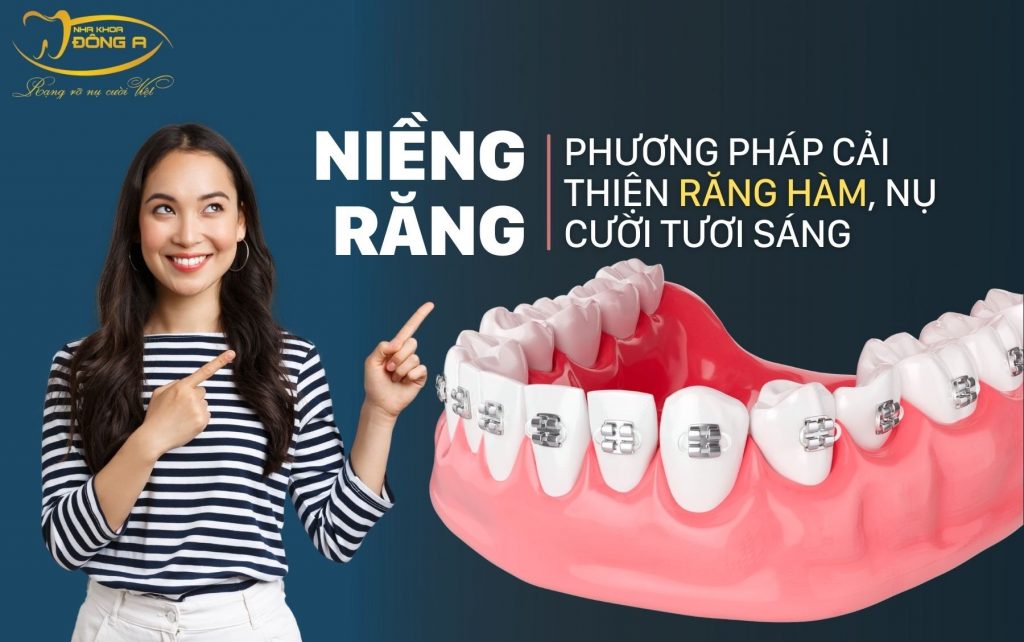 Nieng Rang Phuong Phap Cai Thien Rang Ham