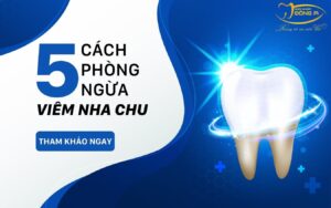 phong ngua viem nha chu