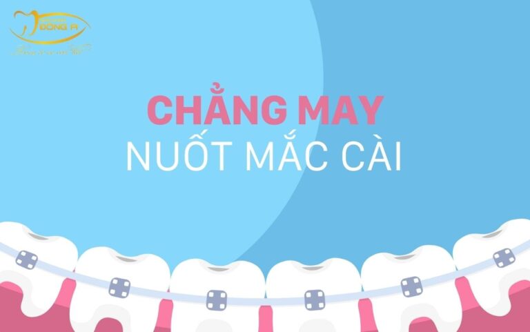 nuốt mắc cài