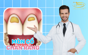mòn cổ chân răng