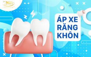 áp xe răng khôn