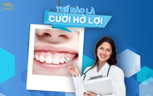 the-nao-là-cuoi-ho-loi