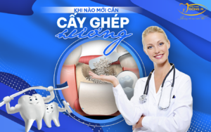 khi-nao-can-cay-ghep-xuong