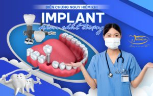 trong-rang-implant-kem-chat-luong
