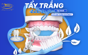 tay-trang-rang-tai-nha