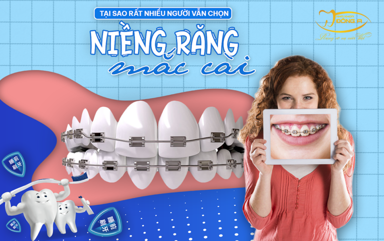nieng-rang-mac-cai-kim-loai