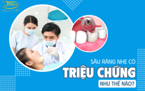 sau-rang-nhe
