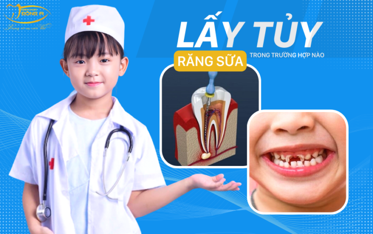 lay-tuy-rang-sua-truong-hop-nao