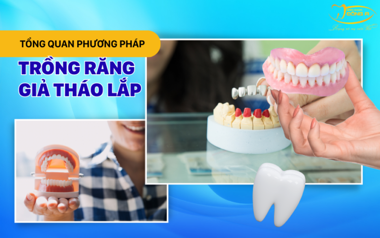 tong-quan-phuong-phap-trong-rang-gia-thao-lap