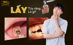 lay-tuy-rang-la-gi