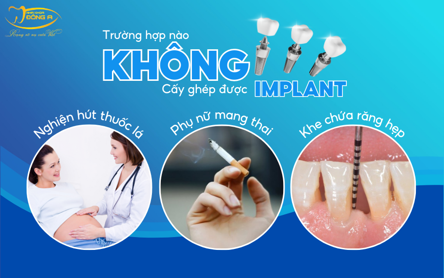 truong-hop-nao-khong-nen-cay-ghep-implant