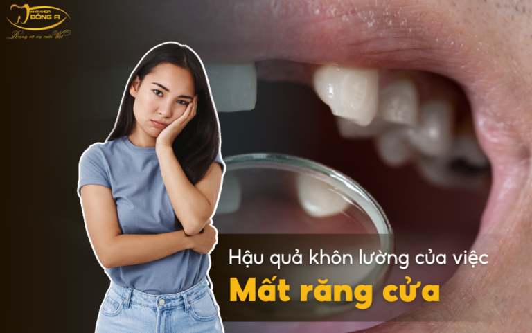 mat-rang-cua