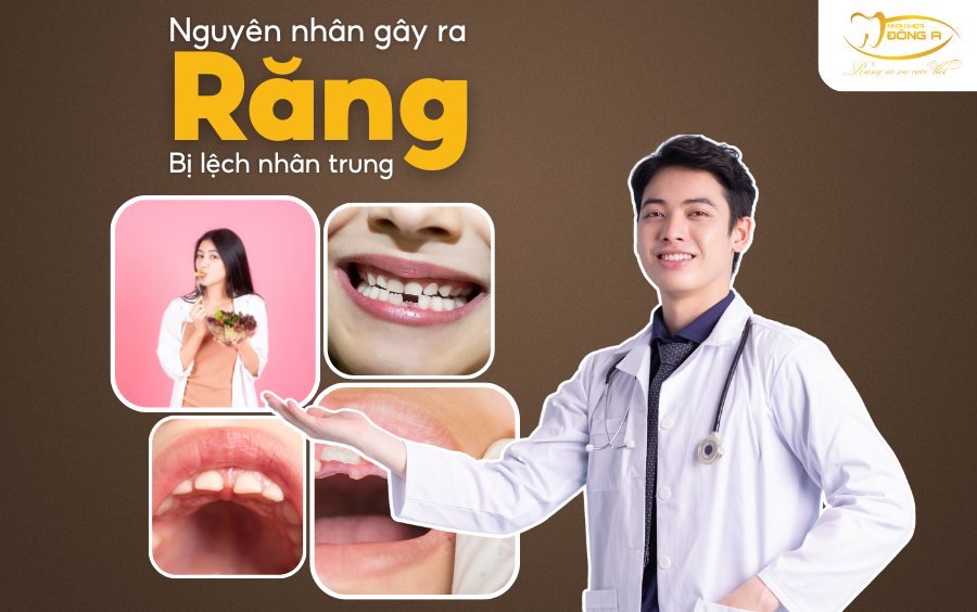 rang-lech-nhan-trung