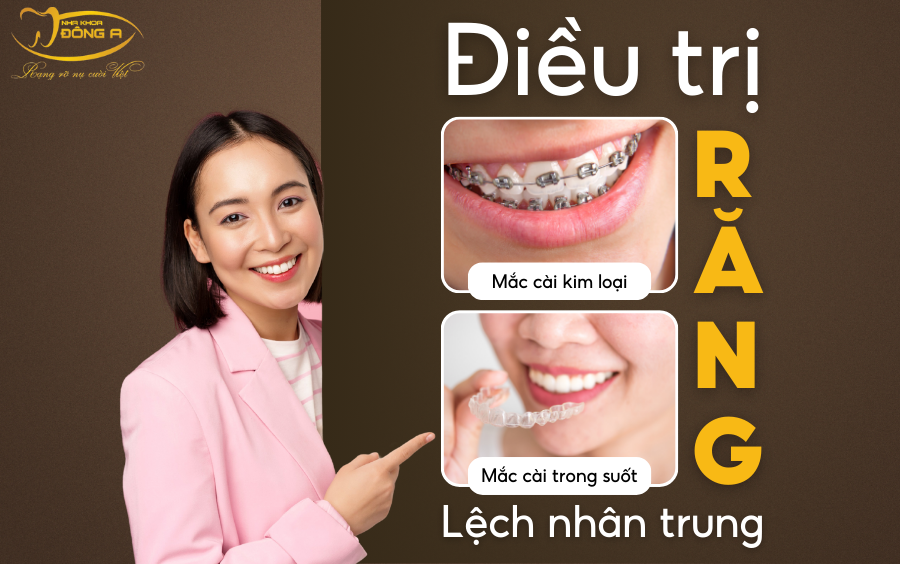 rang-lech-nhan-trung