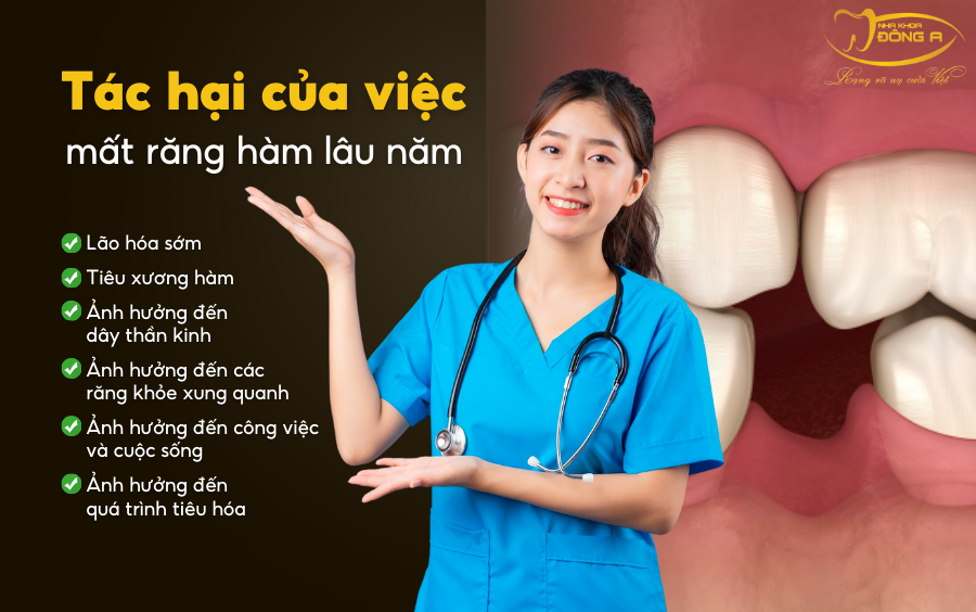 rang-implant