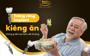 trong-rang-implant
