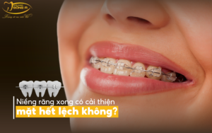 nieng-rang
