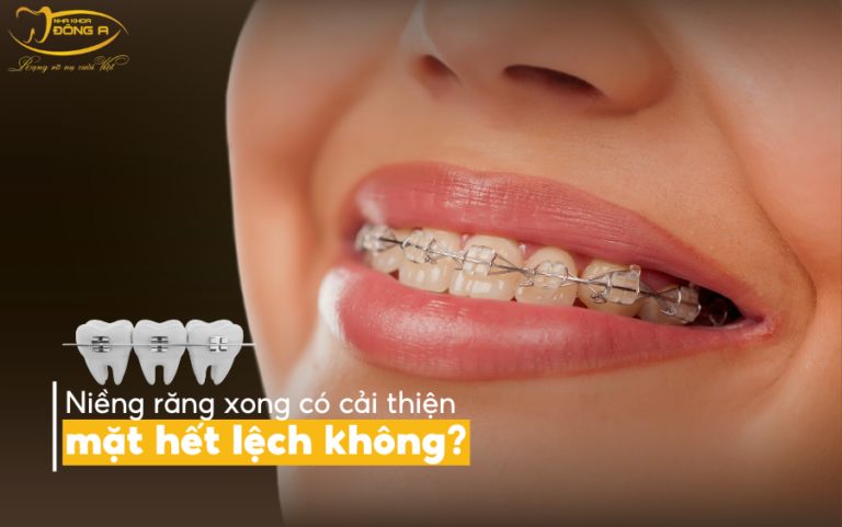 nieng-rang