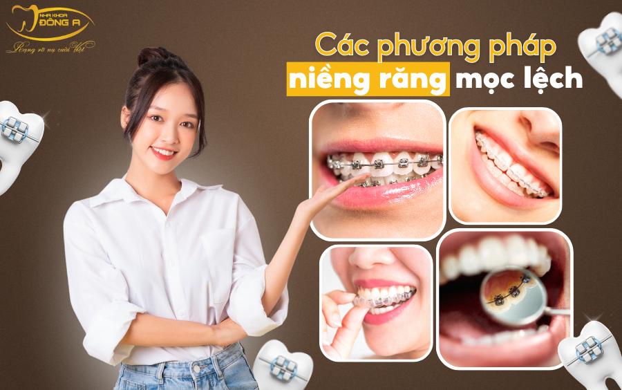 nieng-rang