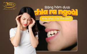rang-ham-duoi