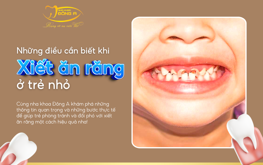 xiet-an-rang-o-tre
