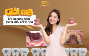 khi-cu-nong-ham