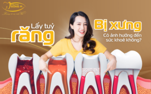 lay-tuy-rang