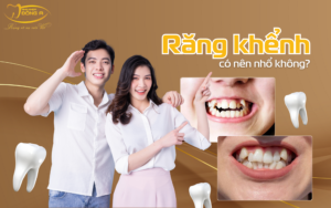 rang-khenh