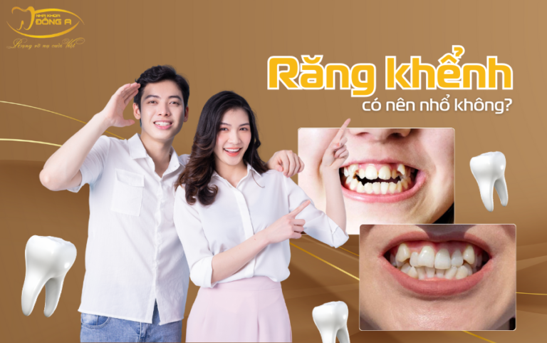 rang-khenh