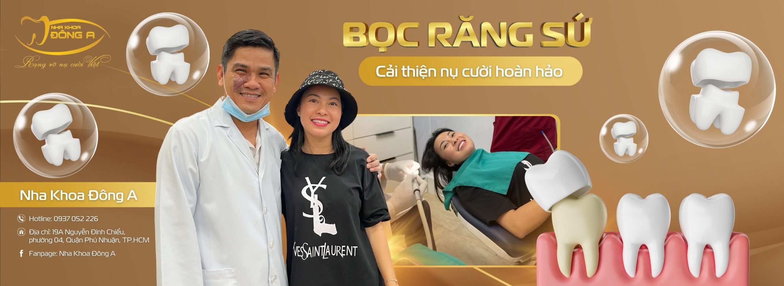 Bọc răng sứ