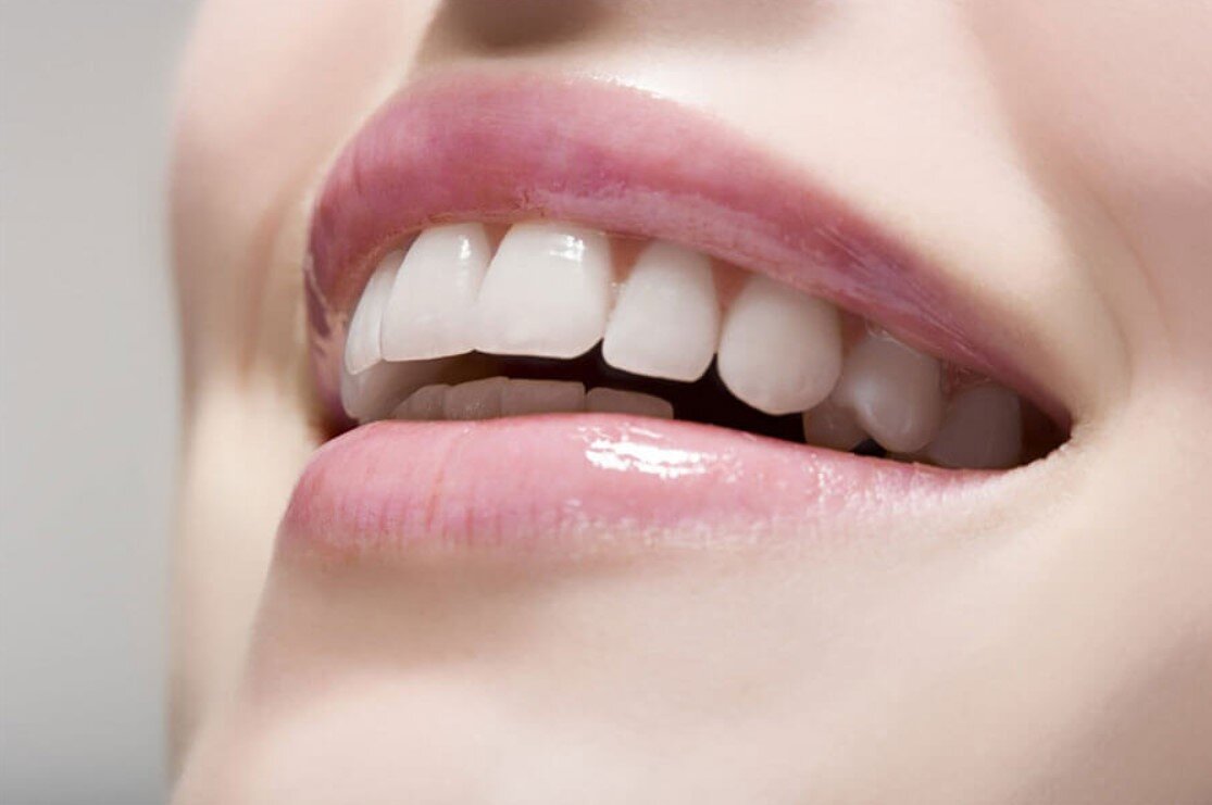 Bọc răng sứ có ảnh hưởng đến răng thật không?
