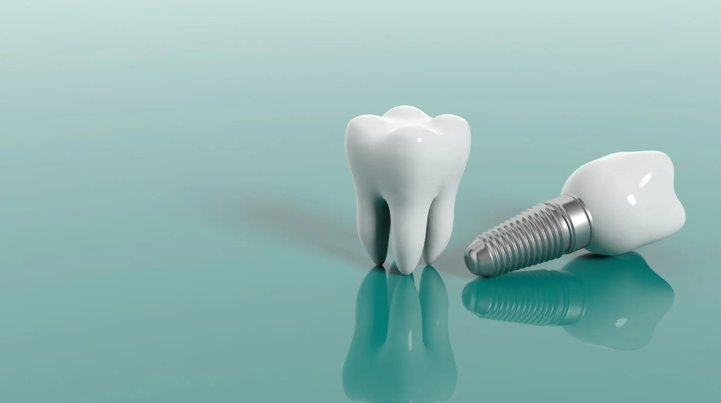 Ưu điểm trồng răng Implant