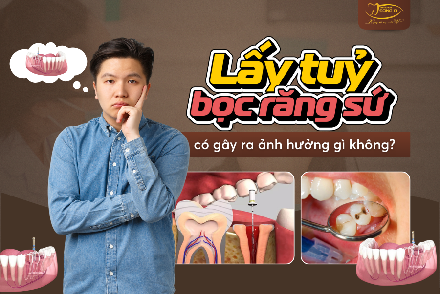 Lay-tuy-boc-rang-su